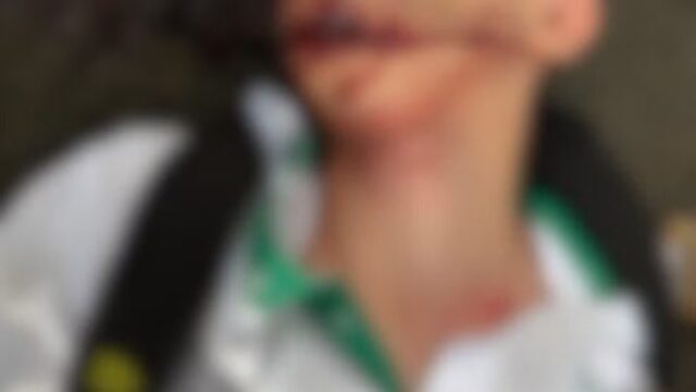 Adolescente fica ferido após atingir fio de internet solto em cruzamento de Uberlândia
