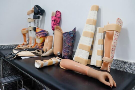 Goiás se destaca no Brasil com produção de próteses personalizadas pelo Crer