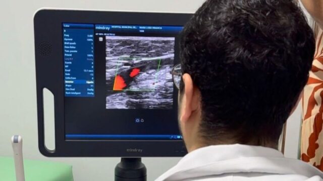 Marzagão amplia atendimentos e passa a oferecer exames de Ultrassom Doppler