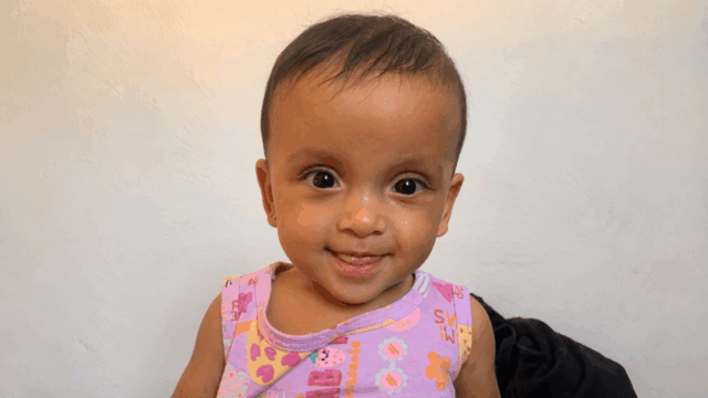Bebê prematura moradora de Catalão precisa de ajuda para tratamento com órtese craniana; família faz vaquinha solidária