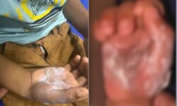 Mãe é presa suspeita de queimar filho de sete anos com colher, em Goiás Mãe é presa suspeita de queimar filho de sete anos com colher, em Goiás